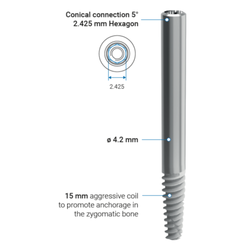 Zygomatic Implants