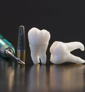 teeth-1 teeth-1